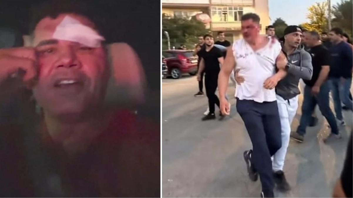 Kaan Kazganın kanlar içerisinde bıraktığı Savaş Cebeciden ilk açıklama Beni yendi helal olsun - Spor - Dudullu Haber