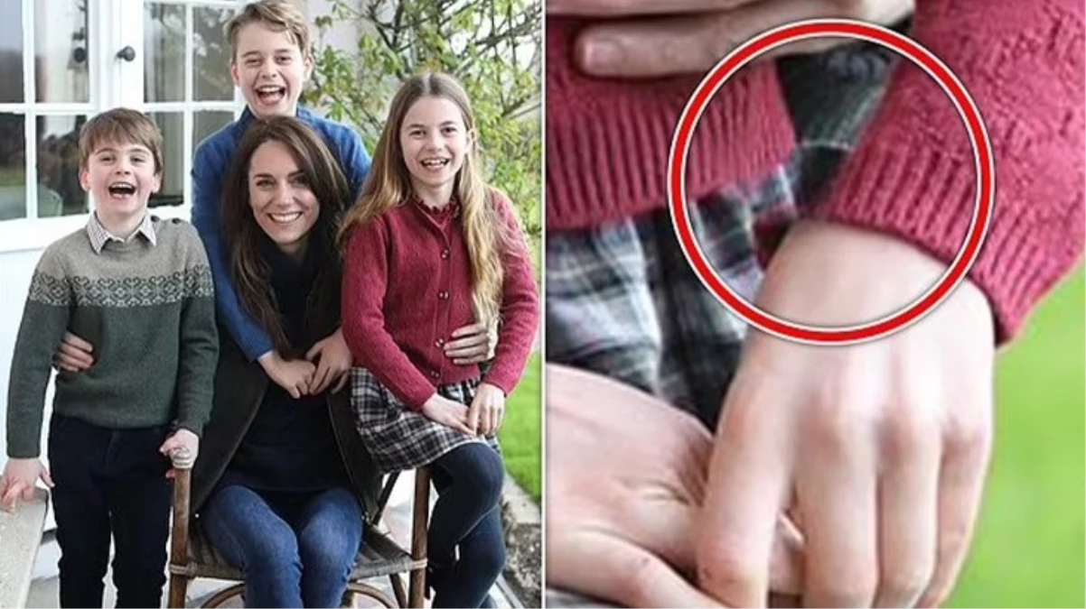 Galler Prensesi Kate Middletonın ameliyat sonrası ilk fotoğrafında montaj iddiası - Magazin - Dudullu Haber