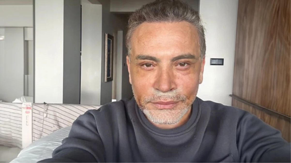 Yüz gerdirme ameliyatı olmuştu İşte Cenk Erenin son hali - Magazin - Dudullu Haber