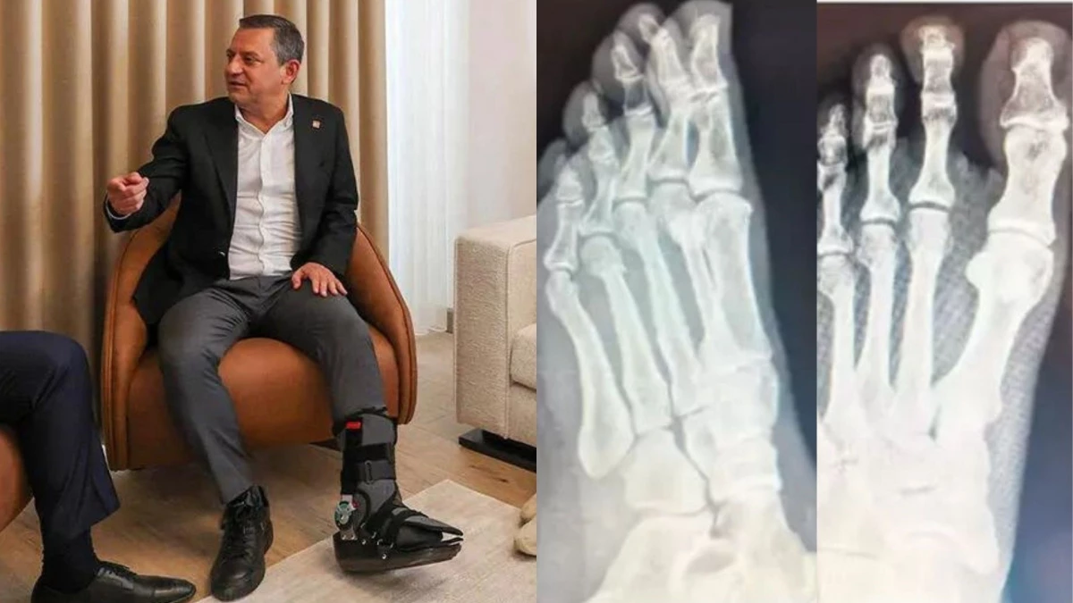 Özgür Özelin ayağına ne oldu CHP lideri Özgür Özelin sağlık durumu nasıl - Gündem - Dudullu Haber