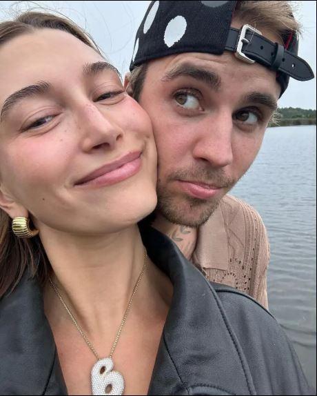 Hailey Bieber, kozmetik markasını 1 milyar dolara satarak millyarderler kulübüne katıldı