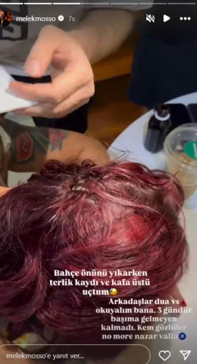 Melek Mosso'ya ne oldu? - SON DAKİKA Melek Mosso kaza mı geçirdi?
