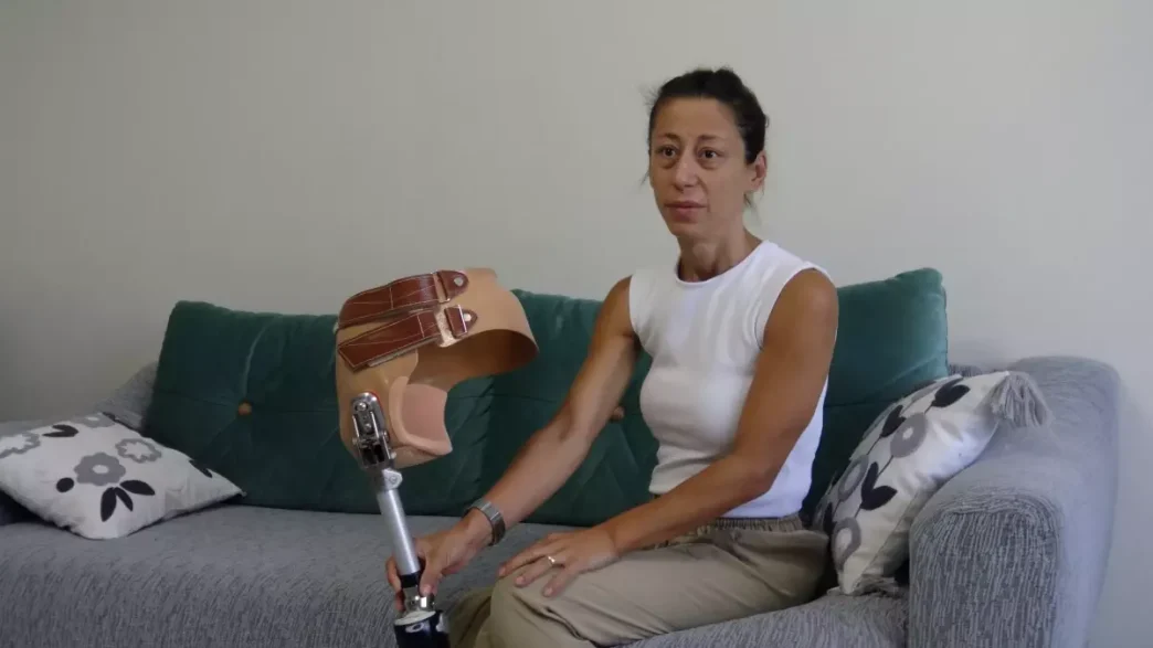 Kemik Kanseriyle Mucadele Eden Anne Yeni Protez Icin Destek Bekliyor