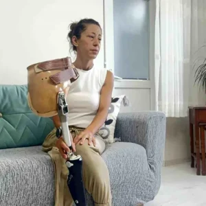 Kemik Kanseriyle Mucadele Eden Anne Yeni Protez Icin Yardim Bekliyor