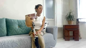 Kemik Kanseriyle Mucadele Eden Anne Yeni Protez Icin Yardim Bekliyor