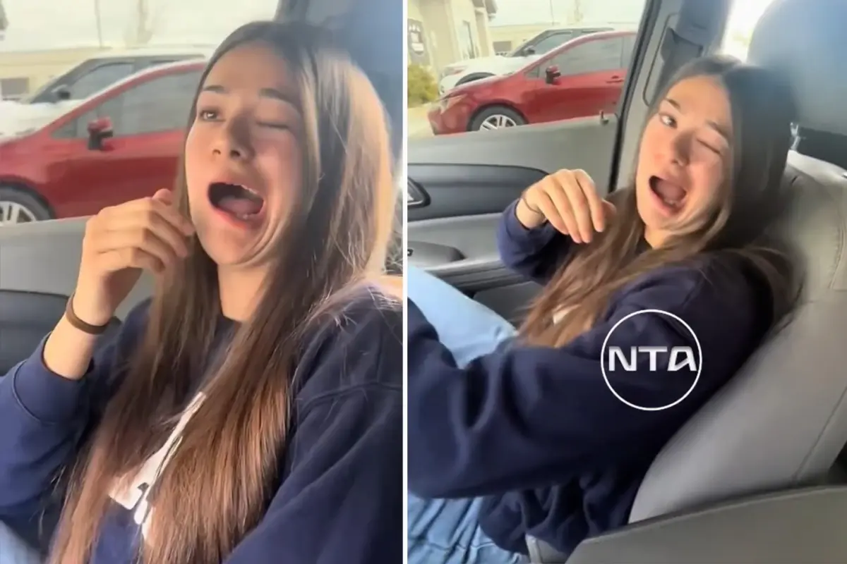 Genc kadinin bir anda agzi kaymaya basladi Tek bir nedeni