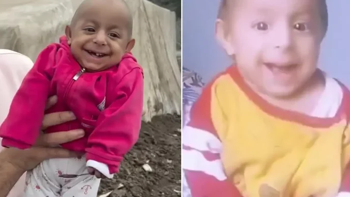Gulen Bebek olarak taninan Okkes Bebek hayatini kaybetti